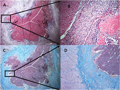 Comparison of gross pathology inspection and 9.4 T magnetic resonance imaging in the evaluation of radiofrequency ablation lesions in the left ventricle of the swine heart